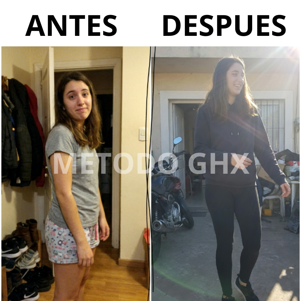 Antes y Después 7